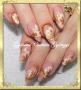 Gold nail