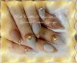 Gold nail