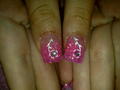 pinky