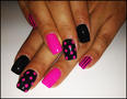 pink fekete