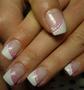 Anett 