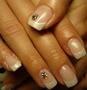 ANETT 