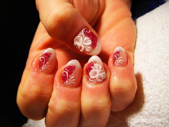 Molnár Zsófi - minike problémás körömre - 2012-01-27 10:22